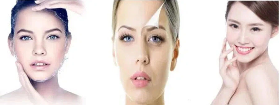 Mandelic Acid